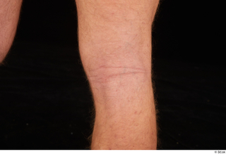 Herbert 10yers knee nude 0002.jpg